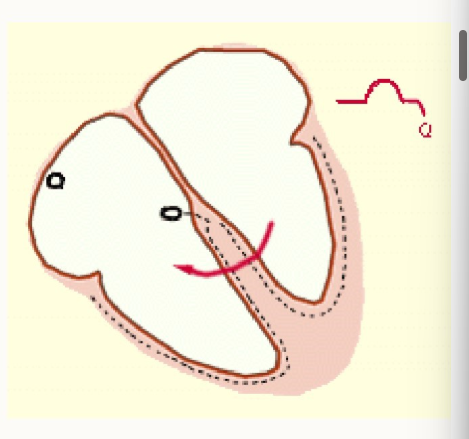 <ul><li><p>when the impulse travels through AV node into bundle of His → L/R bundle branch into purkinje fibres</p></li><li><p>interventricular septum depolarises ready to spread impulse across the ventricles</p></li><li><p>ventricles fill with blood (ventricular diastole)</p></li></ul><p></p>