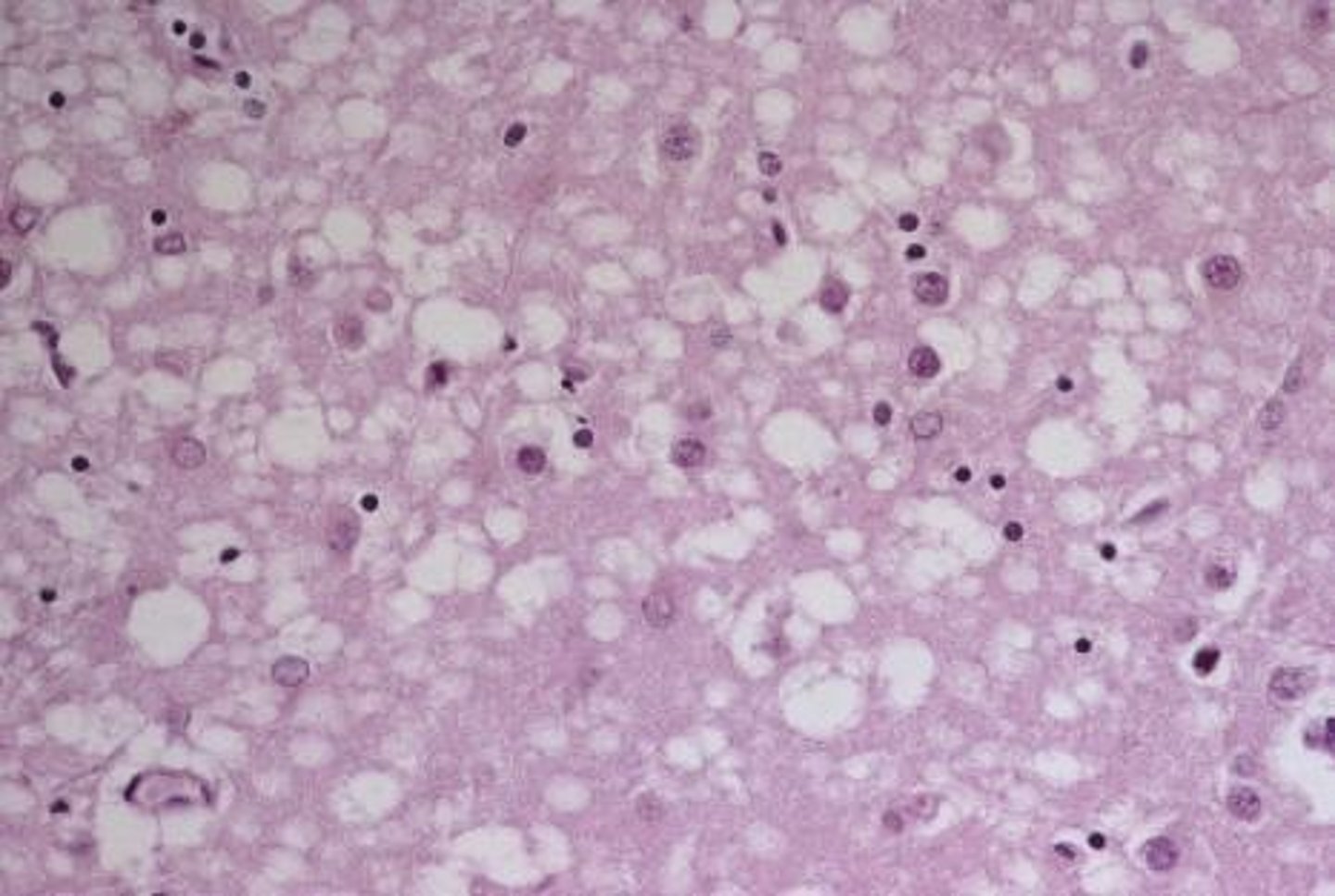 <p>Disorders resulting from abnormal proteins called prions.</p>