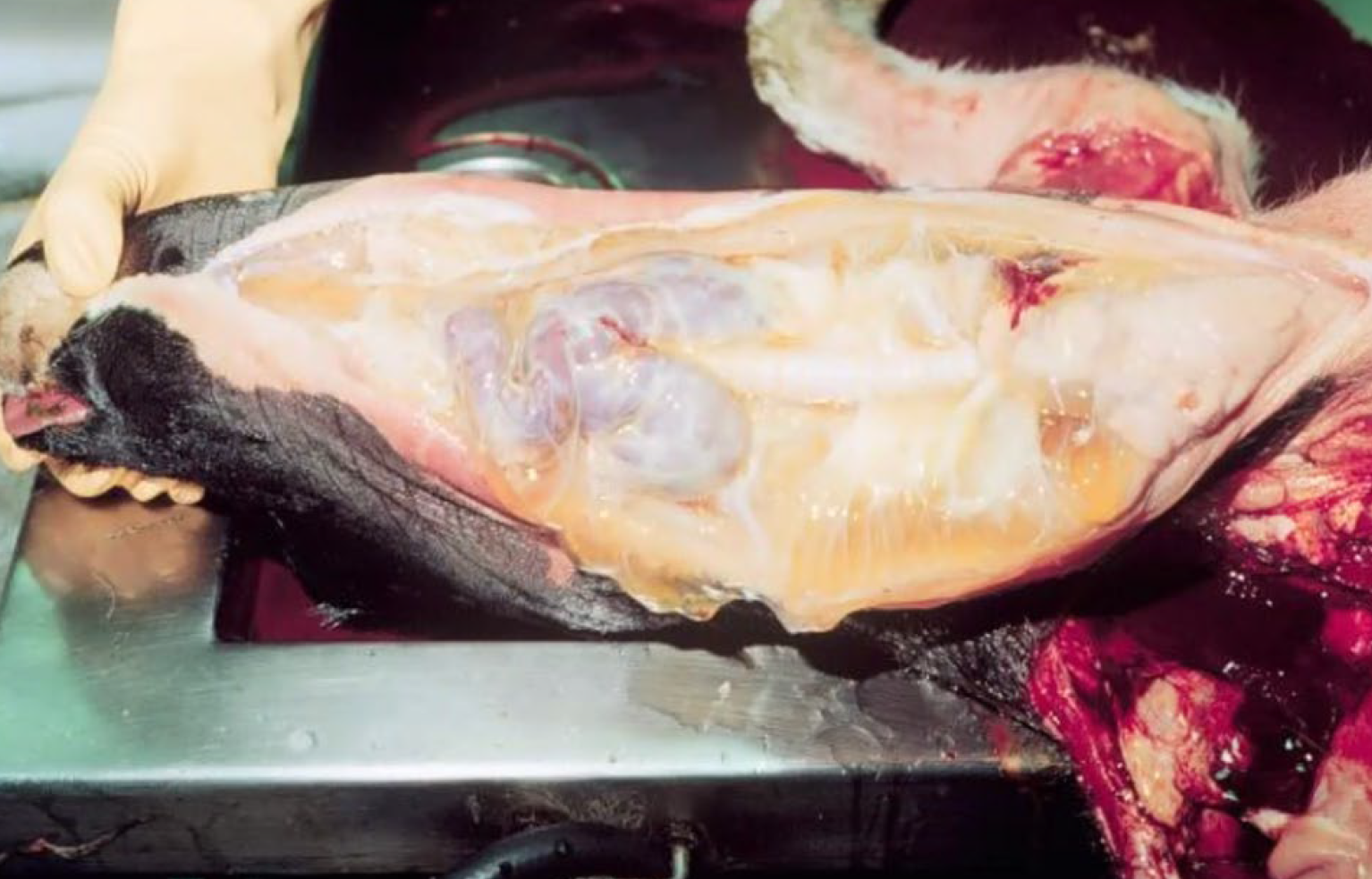 <p>What is the condition?</p><p>A-Lymphoma</p><p>B-Goiter</p><p>C-Mycobacteriosis</p><p>C-Coccidiodomycosis</p>