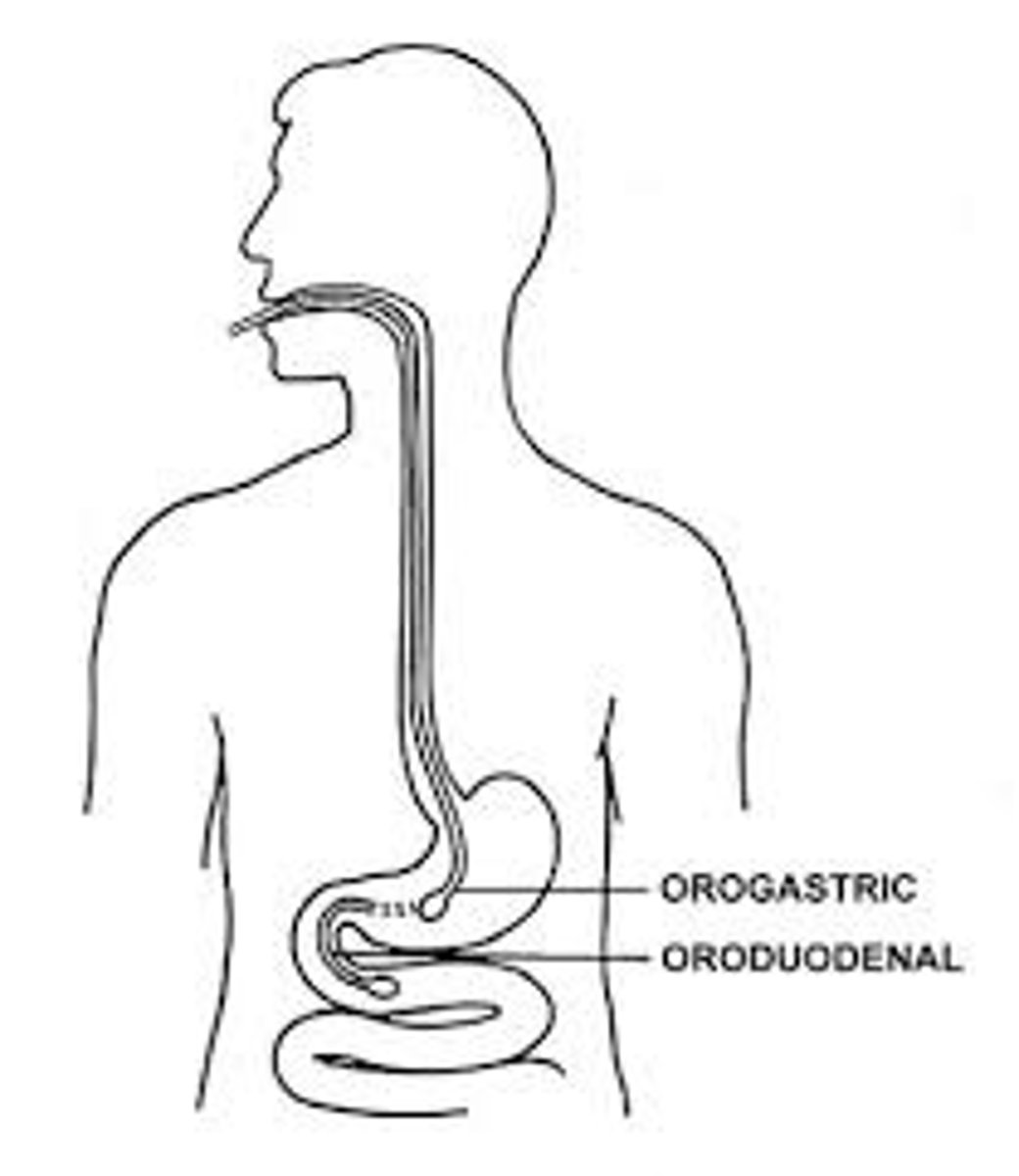 <p>orogastric tube (oral)</p>
