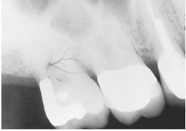 <p>What is the problem with this STATIC ELECTRICITY X-ray?</p>