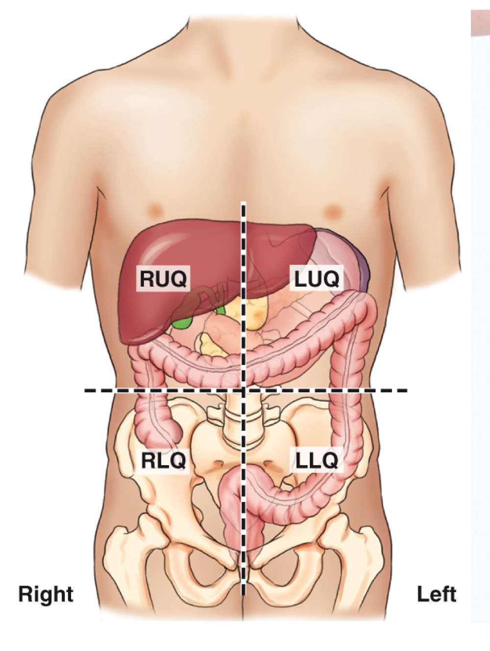 <p>Four regions (RUQ, LUQ, RLQ, LLQ) used to localize organs and pathology within the abdomen.</p>