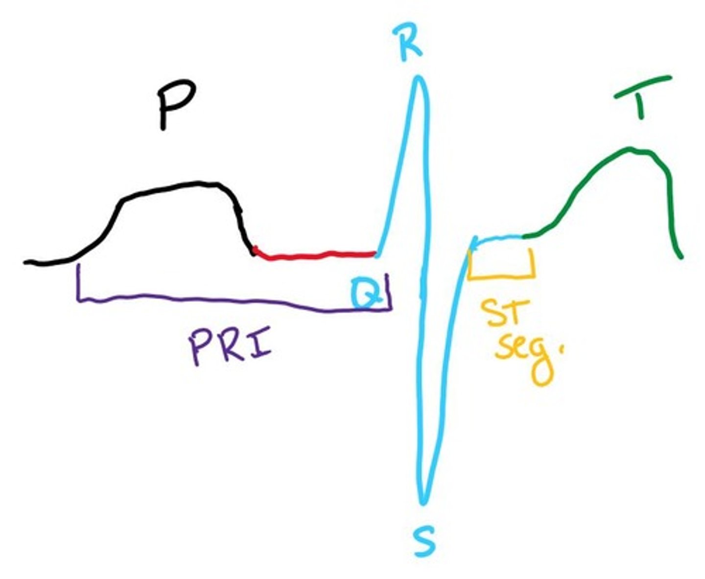 <p>The P wave represents the SA Node.</p>