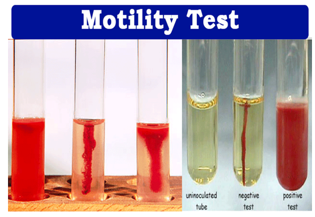 <p><span>if you get a red color after adding Kovac’s reagent, its indole-positive&nbsp;</span></p>