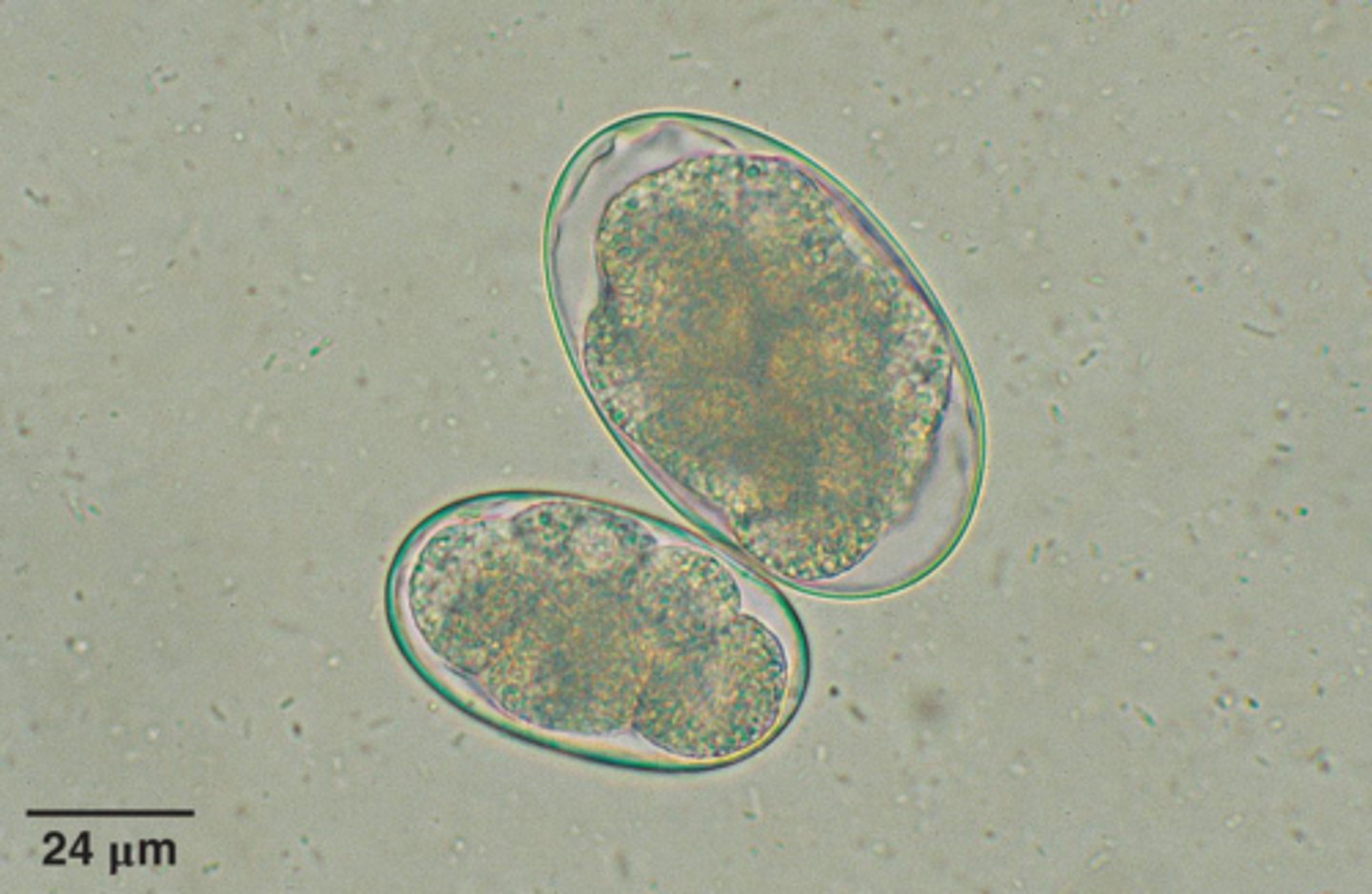 <p>What parasite is this if it is from a dog</p>