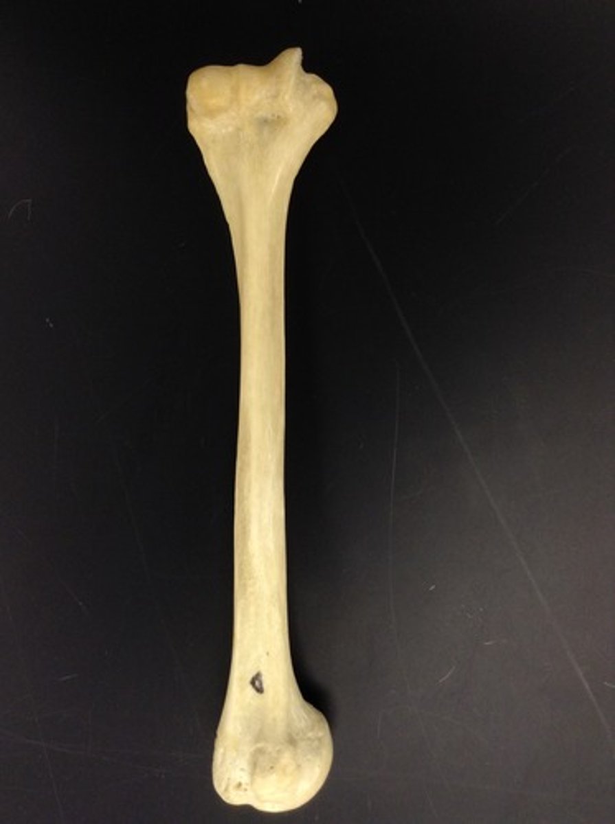 <p>ID bone</p>
