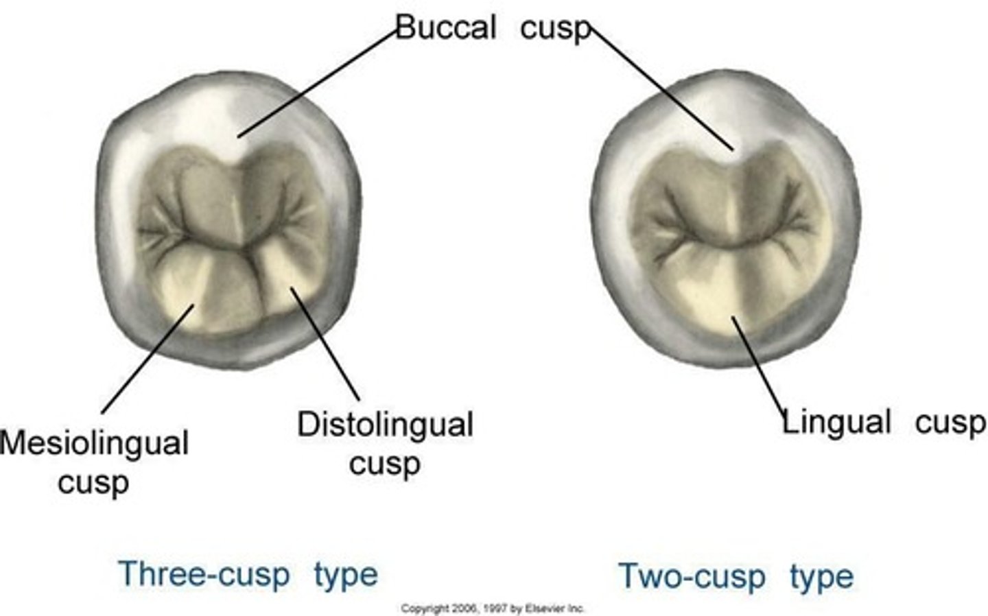 <p>Less common form with single lingual cusp.</p>