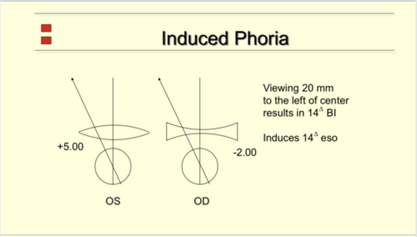 <p>OD: -2.00</p><p>OS: +5.00</p><p>A patient is viewing 20mm to the right of optical center. What is the induced phoria of each eye?</p>