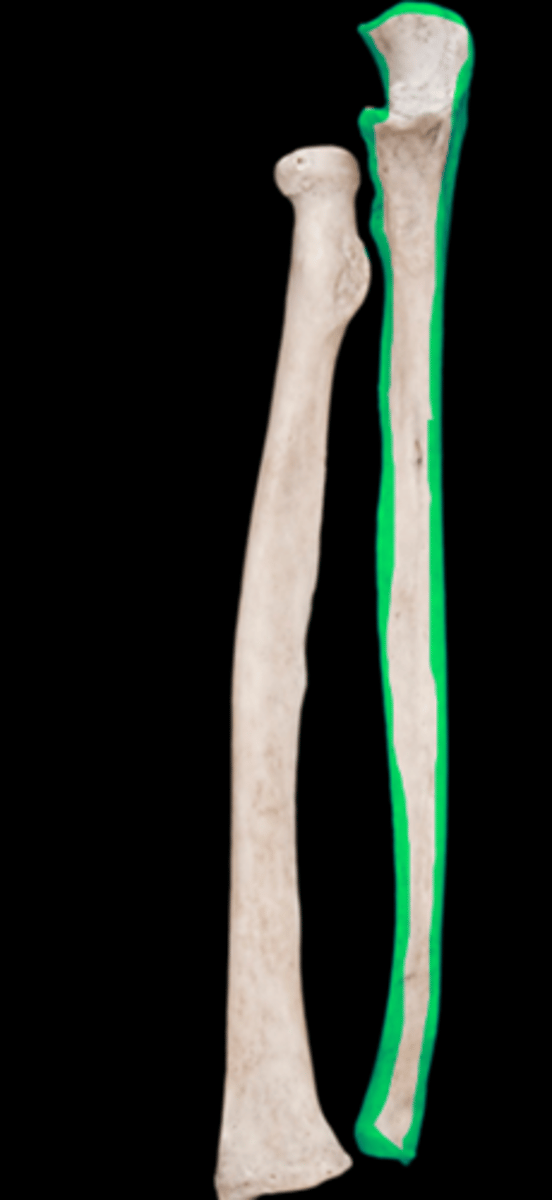<p>name the bone</p>
