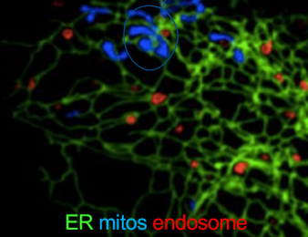 <p>you have learned that mito and er form membrane contact sites. which of the following experiments would be allow you to determine if the er controls the morphology of mito </p>