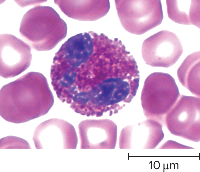 eosinophil