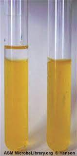 <p>What 3 genera are <strong>curved GNRs</strong> that are <strong>oxidase +</strong> and <strong>ferment glucose (oxidizers in O/F)</strong>?</p>
