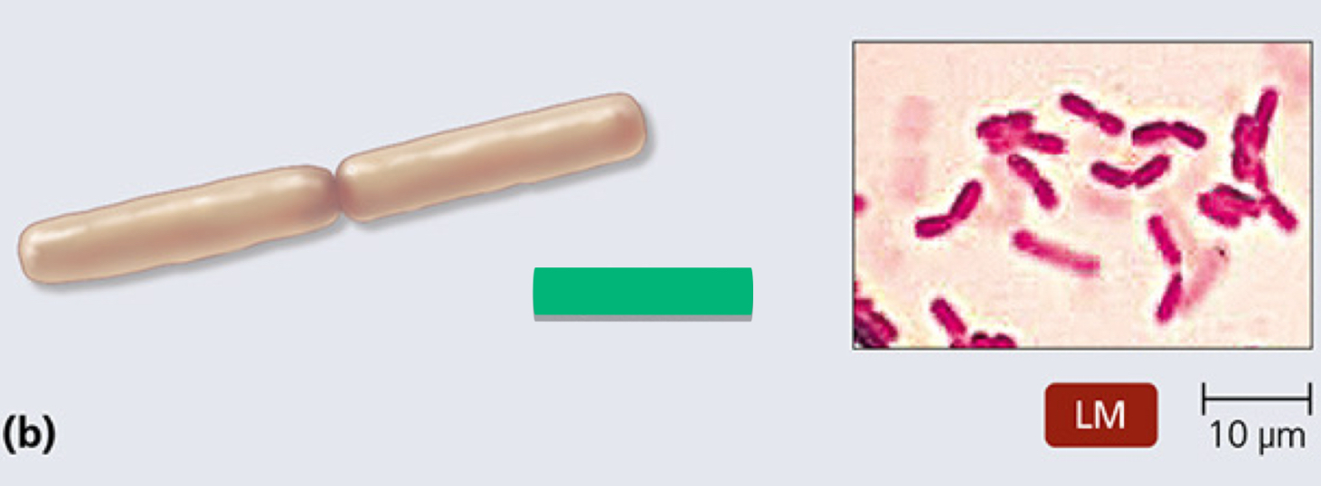 <p>What is the arrangement of this prokaryotic cell?</p>
