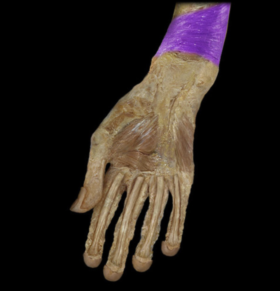 <p><em>table 1, median n (C8-T1), forearm pronation</em><br><em>lies deep to the flexor tendons</em></p>