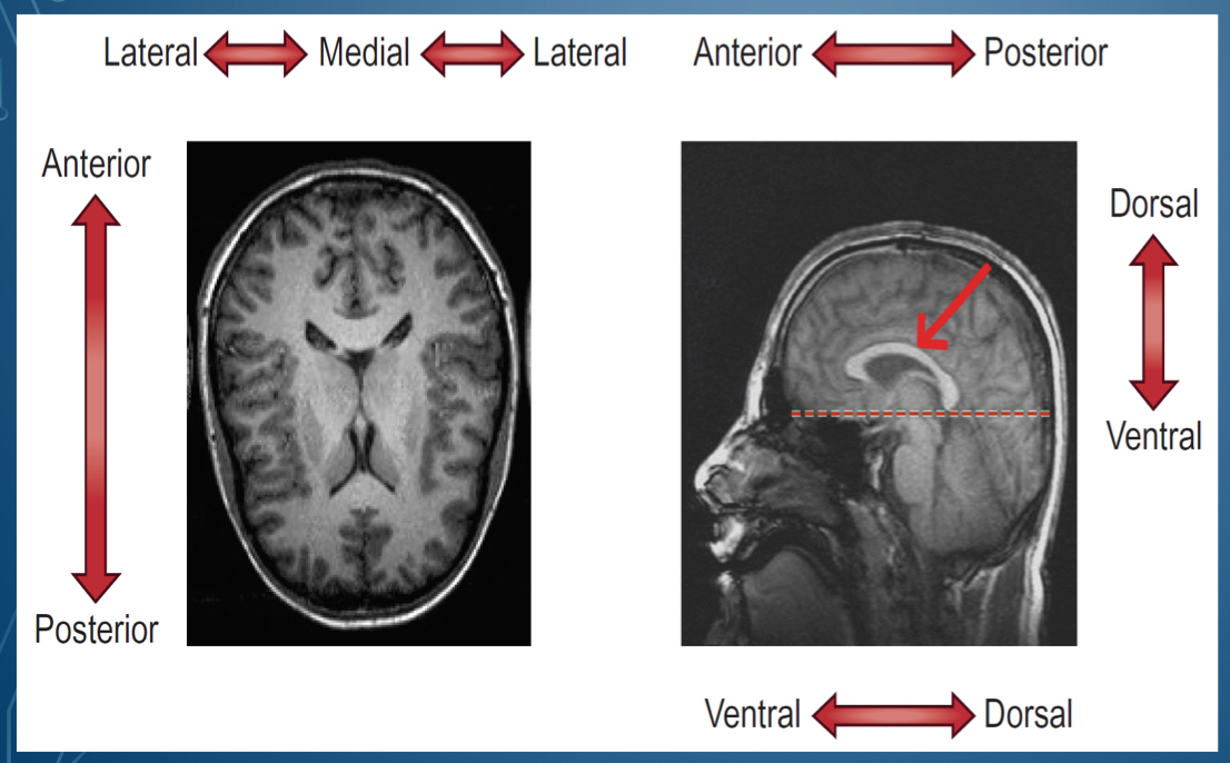 <p>opposite of dorsal bottom of brain</p>