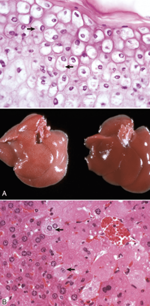 <p>What type of reversible cell injury is shown in these images?</p>