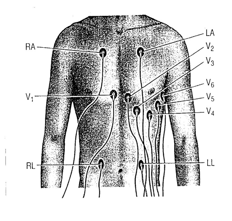 <p>Lab -  ECG</p>