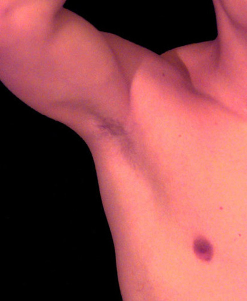 <p>areas with higher moisture (ex. armpits)</p><p>metabolize sweat and contribute to body odor</p>