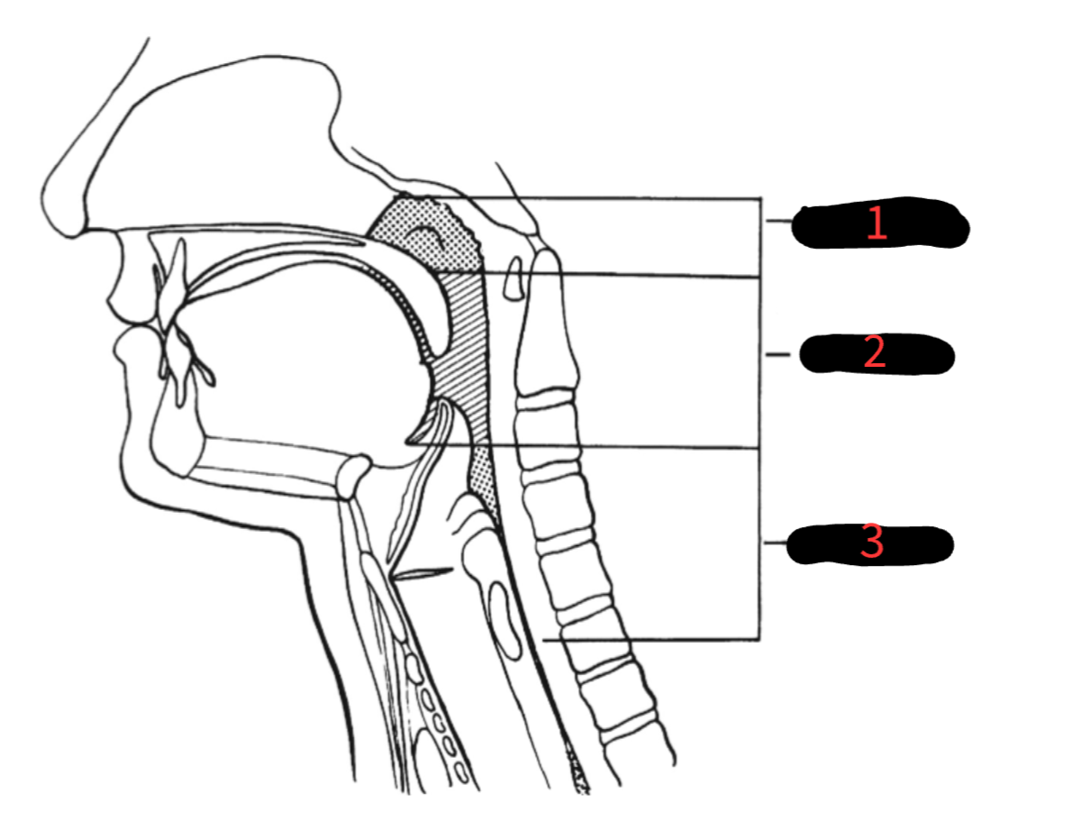 <p>What is the area labelled 3?</p>