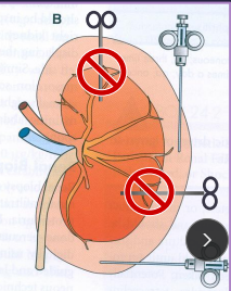 <p><span>Kidney Surgical Considerations and Procedures</span></p>