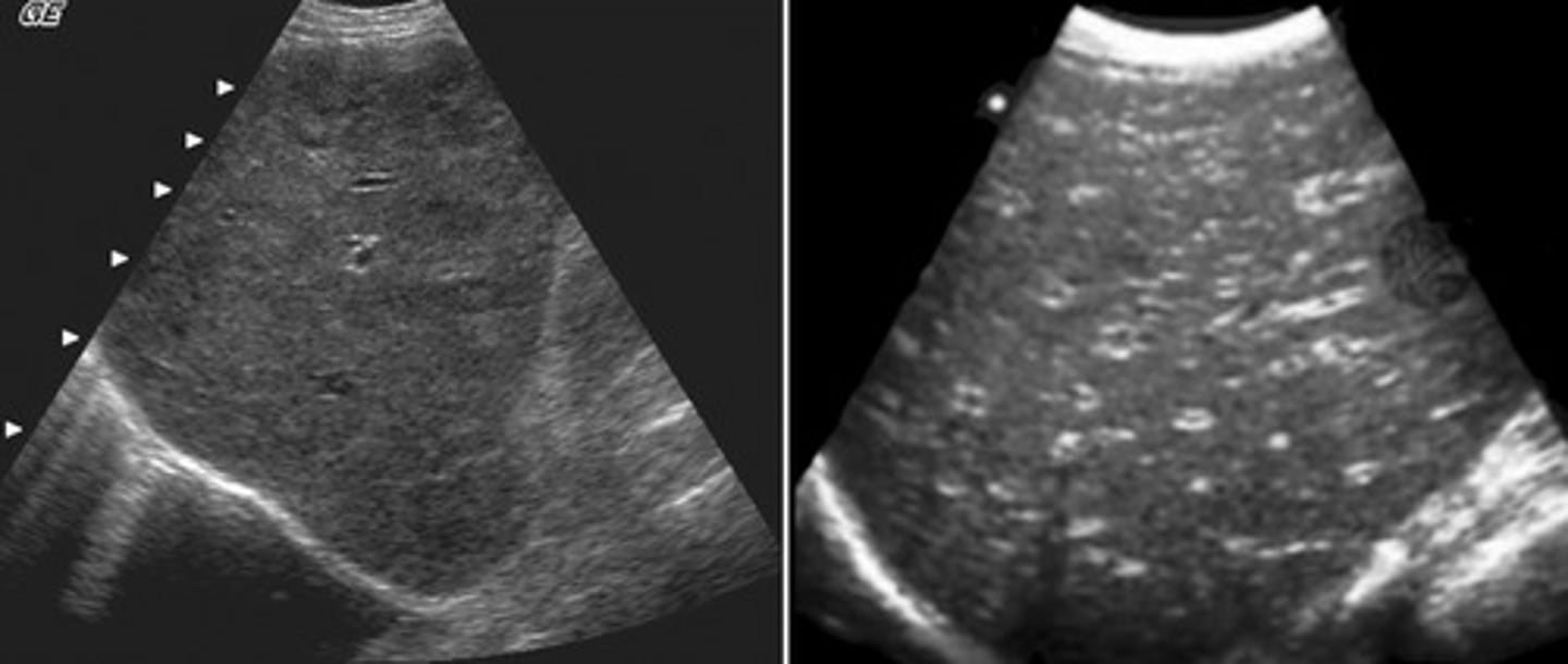 <p>Normal to hypoechoic parenchyma</p><p>Portal vein walls are very visible -> starry sky</p><p>Splotchy/inhomogenous</p><p>Hepatomegaly</p><p>Splenomegaly</p>