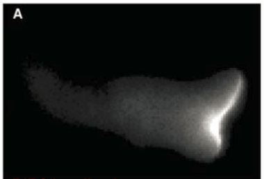 <p>usually controls actin polymerization; on plasma membrane; front of cell; part of major signaling pathway that leads to T-cell activation, proliferation, and cell survival</p>