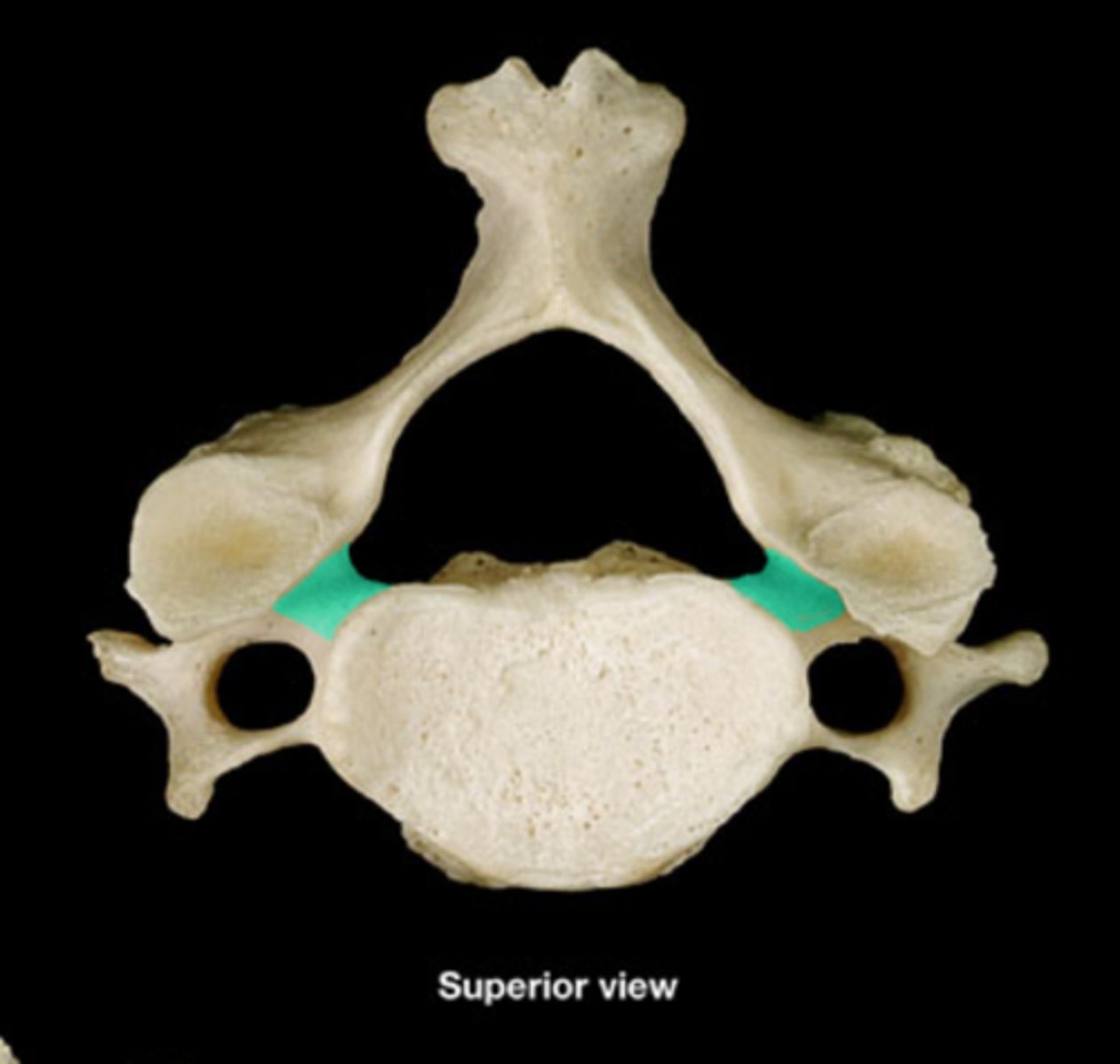 <p>a stub of bone that connects the lamina to the vertebral body to form the vertebral arch</p>