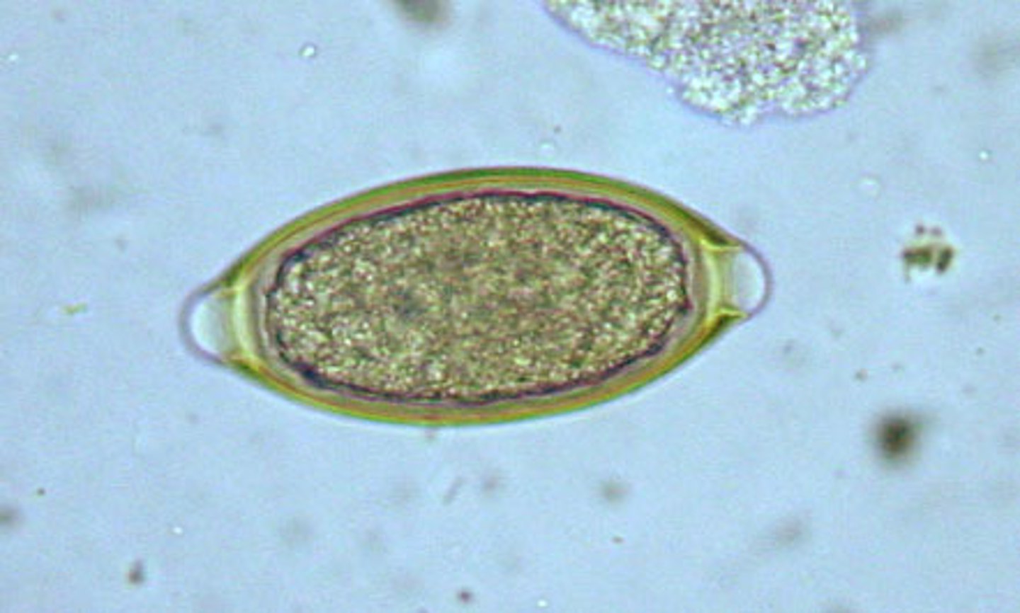 <p>feline whipworms</p>