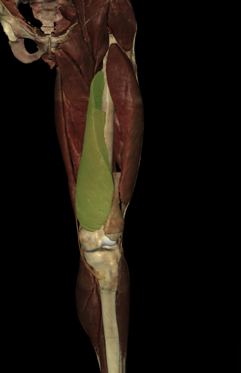 <p>Identify the Structure</p>
