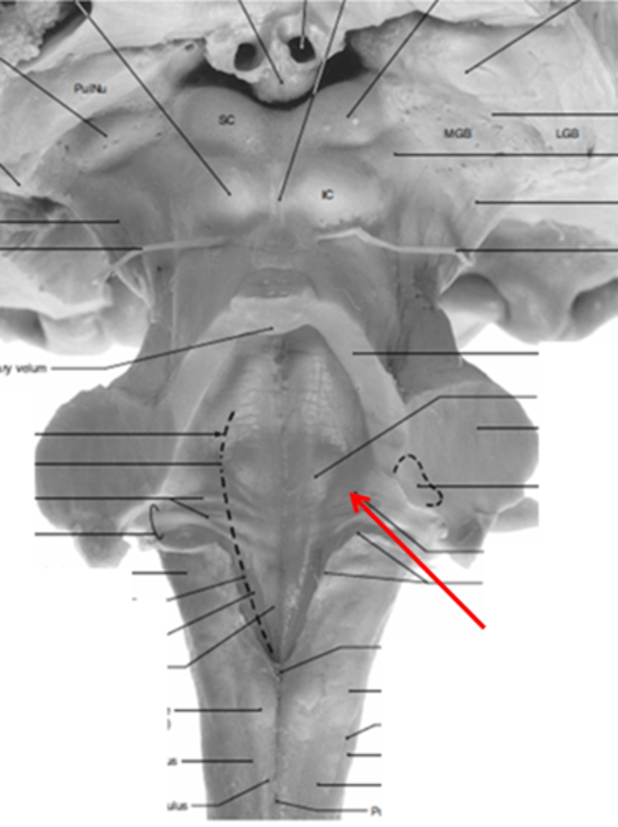 <p>vestibular area</p>