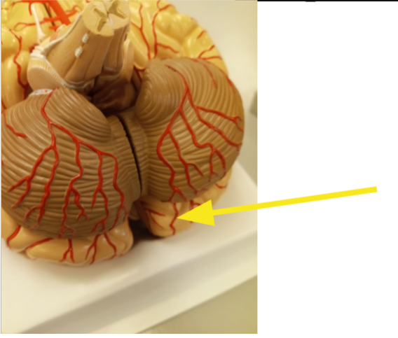 <p>What lobe is this? Back portion near cerebrum</p>