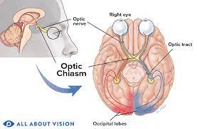 <p><strong><u>Vision (Mod 18)</u></strong></p><p>Part of the brain where the optic nerves cross and is therefore of primary importance to the visual pathway</p>