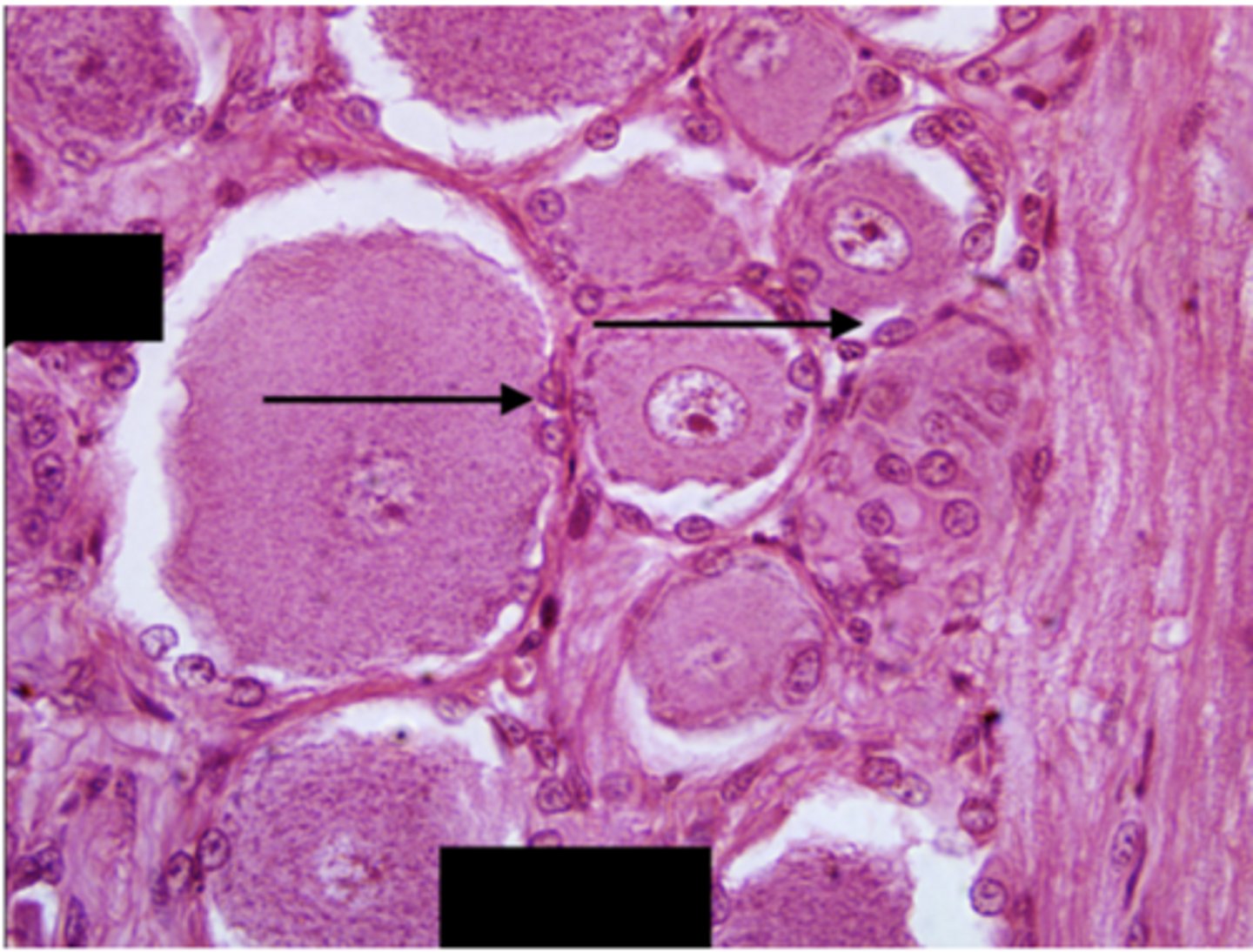 <p>Identify the cells (black arrows)</p>