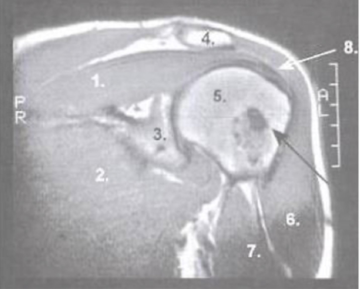 <p>What is number 3?</p>