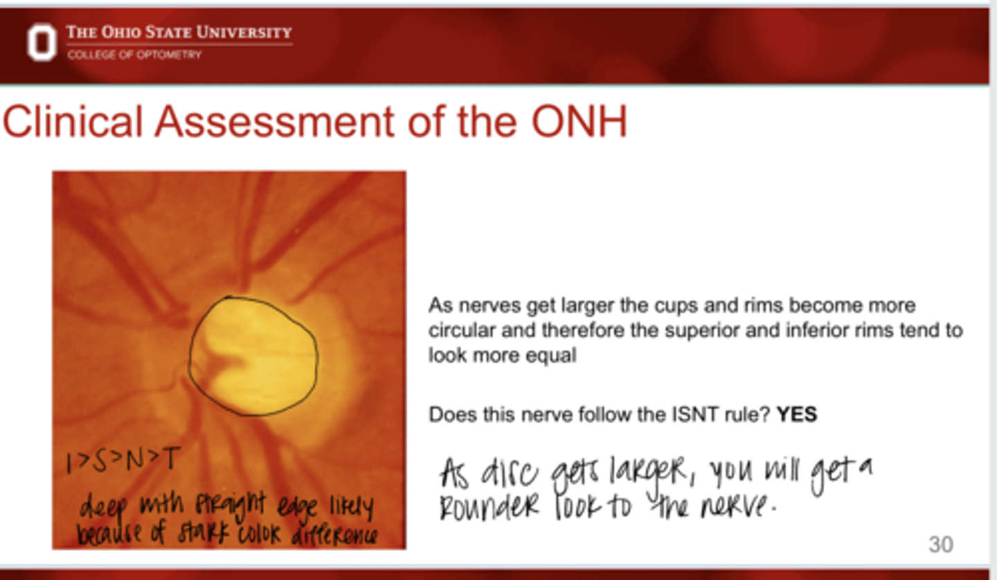 <p>As nerves get larger, the cups/rims become more circular and therefore the superior and inferior rims tend to look more ______</p>