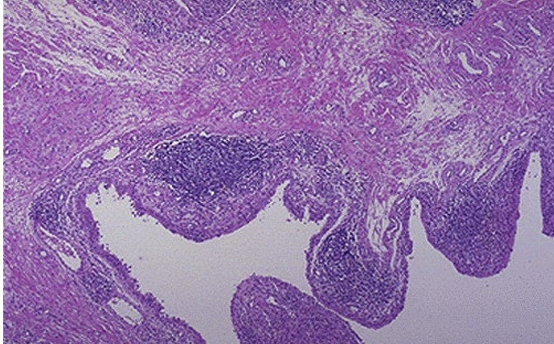 <p>What condition is this</p>