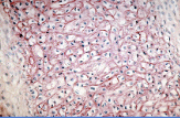 Location: external ear, epiglottis, eustachian tubes
Structure:  chondrocytes appear closer together and more elastic fibers than hyaline cartilage.
Function: make structure flexible