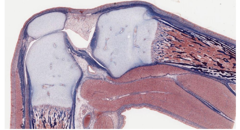 <p>Articulaci贸n sinovial</p>