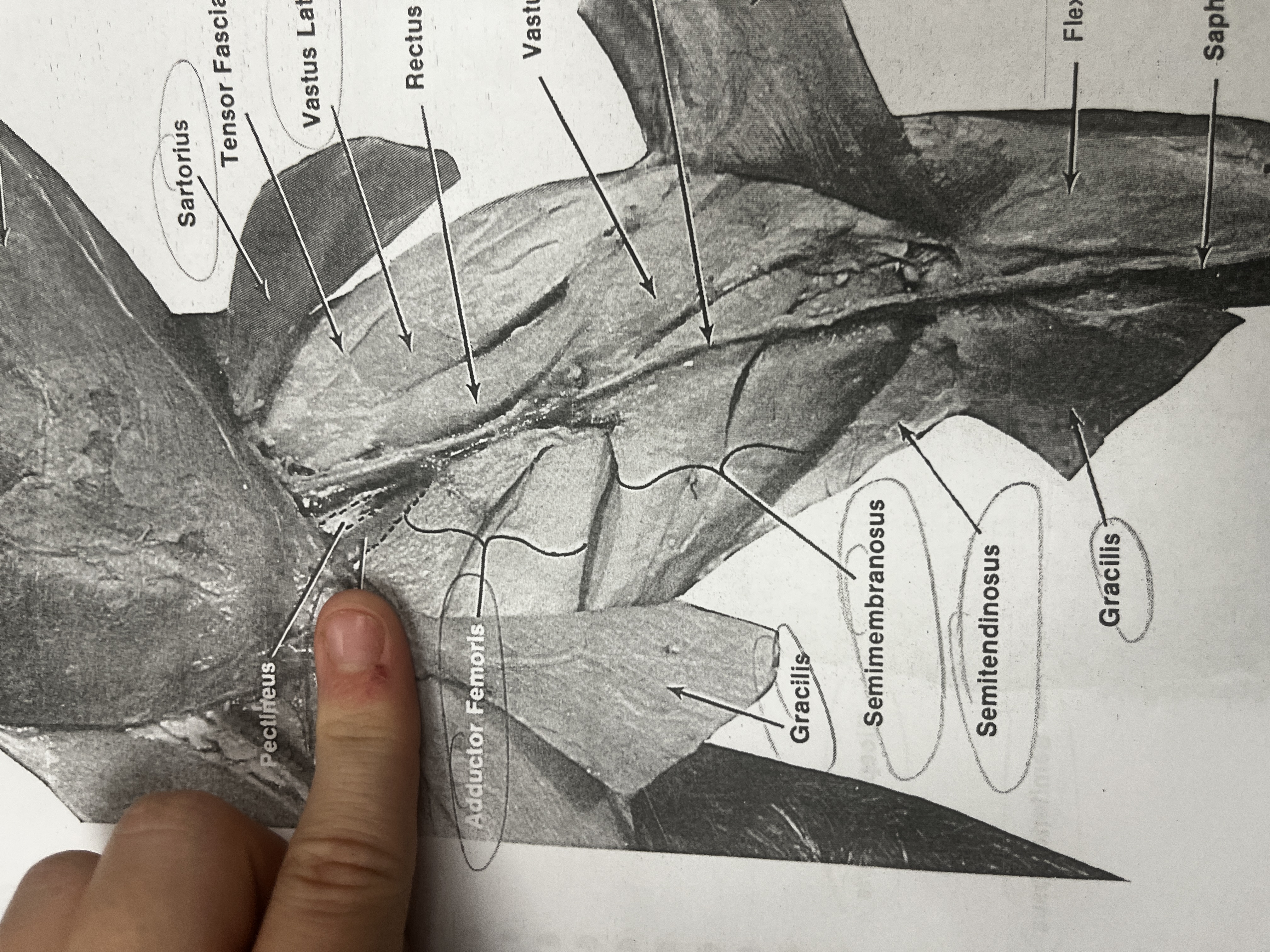 <p>A muscle of the thigh that helps bring the leg toward the midline of the body.</p>