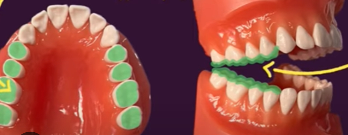 <p>Chewing surface of the posterior teeth</p>