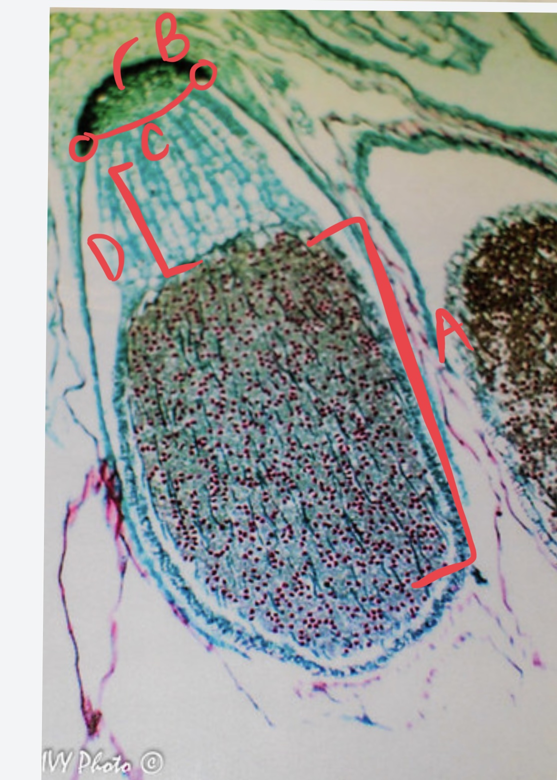 <ul><li><p>which organism is this?</p></li><li><p>sporophyte or gametophyte? (result of fertilization, hangs upside down on female plant)</p></li><li><p>label</p></li></ul>