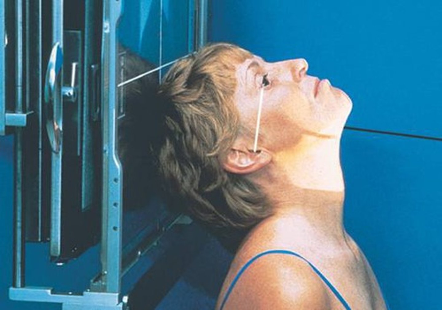 <p>What is this projection?</p><p>How is Patient positing?</p><p>What is the CR?</p><p>What are the structures shown?</p>