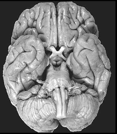 <p>inferior</p>