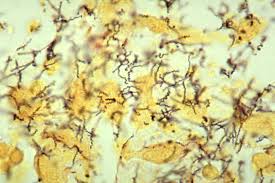 <p>what is the organism</p>