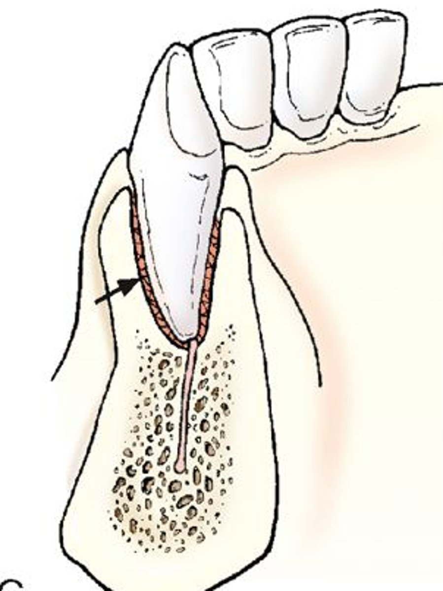 <p>peg and socket type joint with little movement</p>
