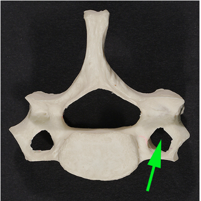 <p>What is the opening marked by the green arrow?</p>