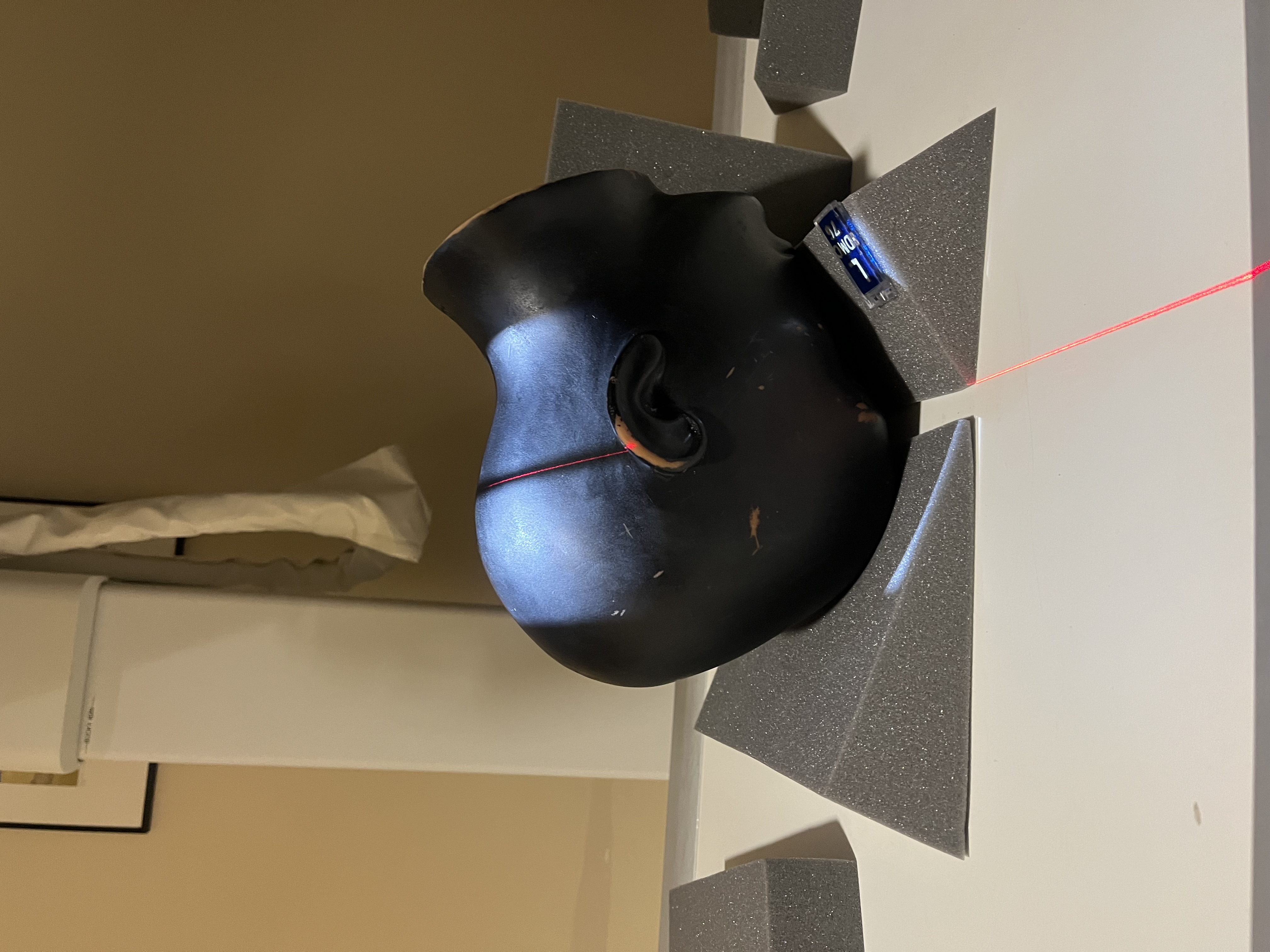 <p>SID ; 40</p><p style="text-align: start">COLLIMATION; 19 × 19</p><p style="text-align: start">CR- 15* caudad to exit at Naision</p><p style="text-align: start">TECHNIQUE 85 kvp at 10 MAs</p>