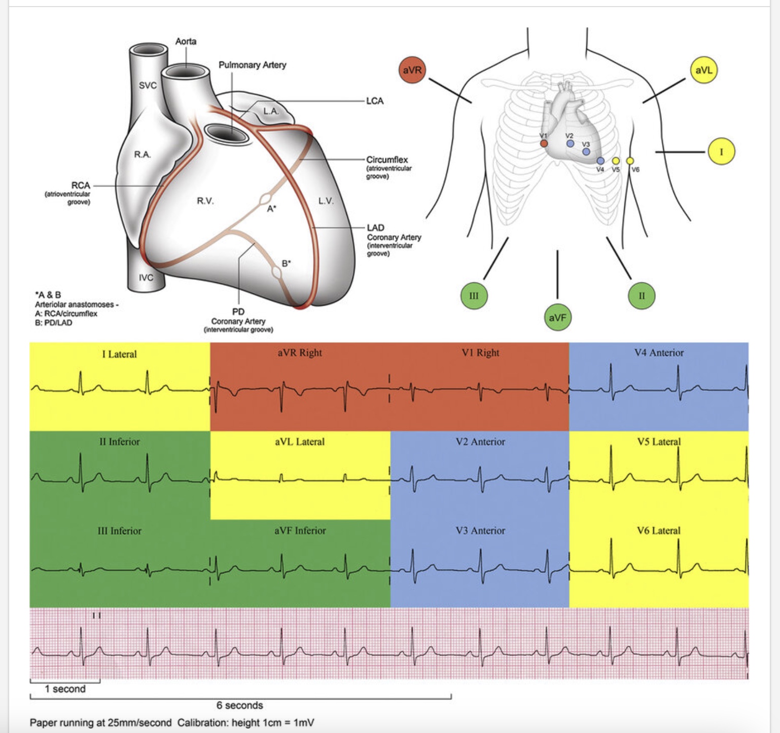 <p>II, III, aVF → inferior aspect</p><p>I, aVL, V5, V6 → lateral aspect</p><p>aVR, V1 → right side</p><p>V2, V3, V4 → anterior aspect</p>