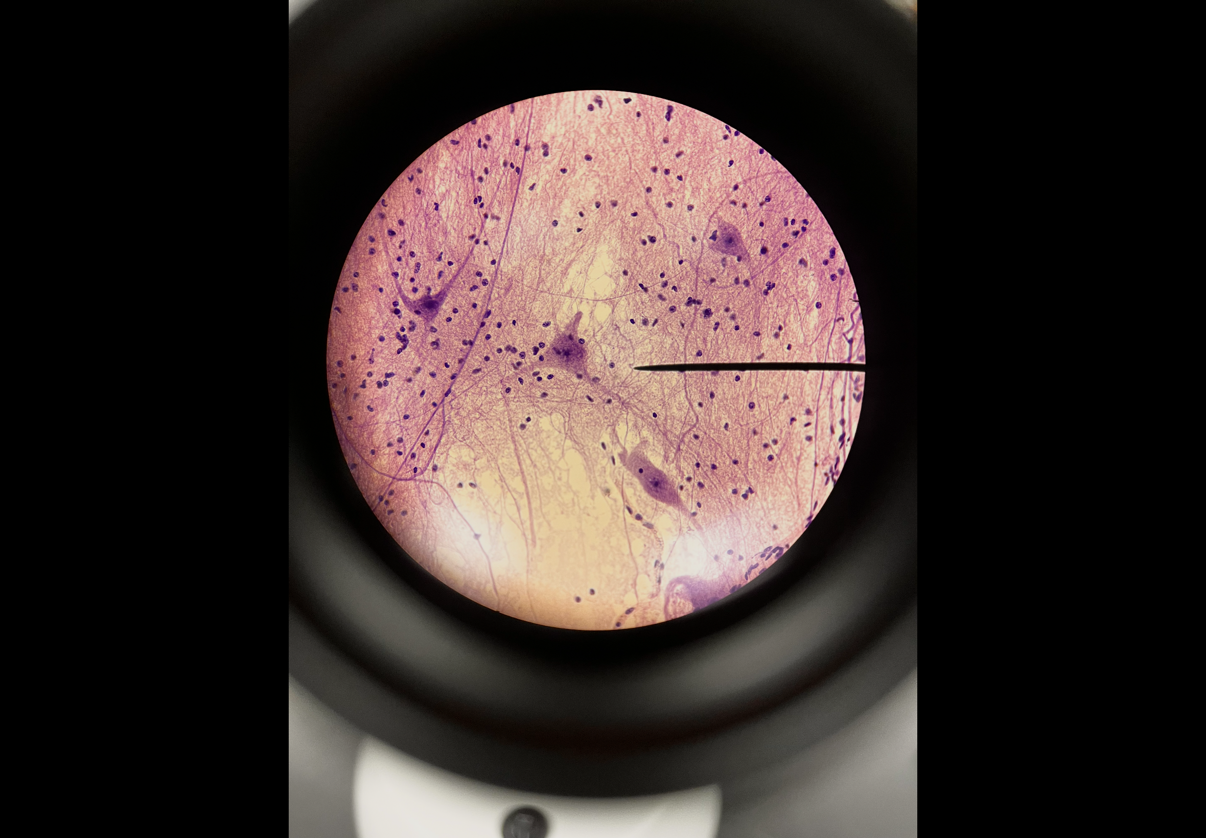 <p>Body location: nervous system</p>