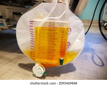<p>Why should urine collection bags not be allowed to become overfull?</p>